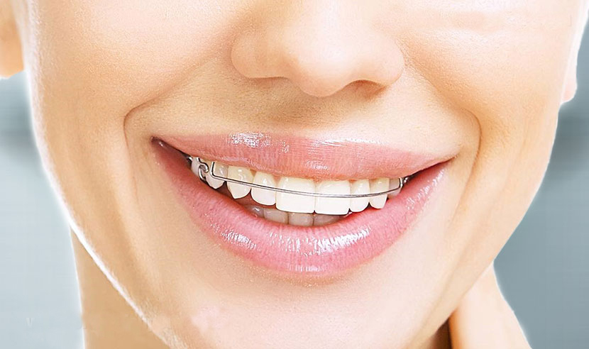 ارتودنسی می تواند طول عمر دندان ها را افزایش دهد