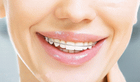 ارتودنسی می تواند طول عمر دندان ها را افزایش دهد